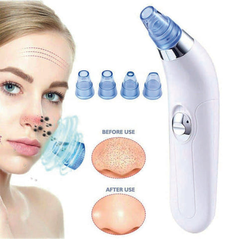 Blackheads and POres Remover Machine